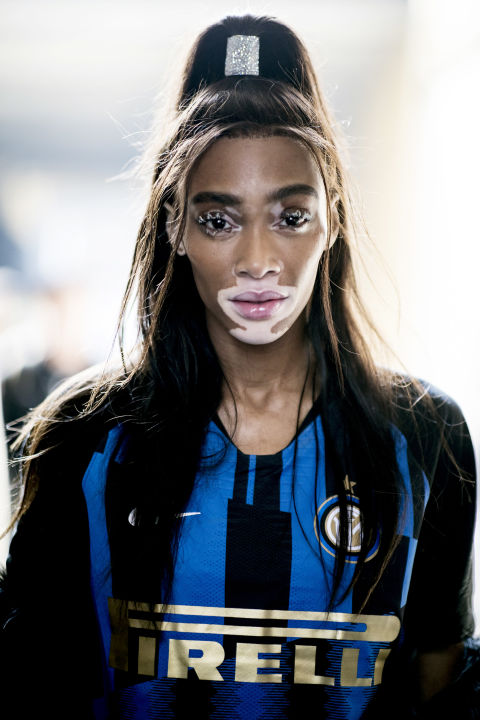 `Winnie Harlow