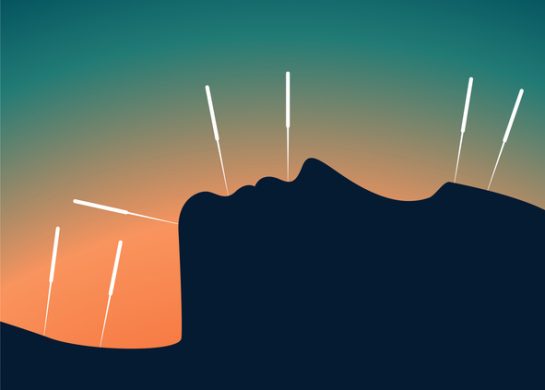 akupunktura, benefiti