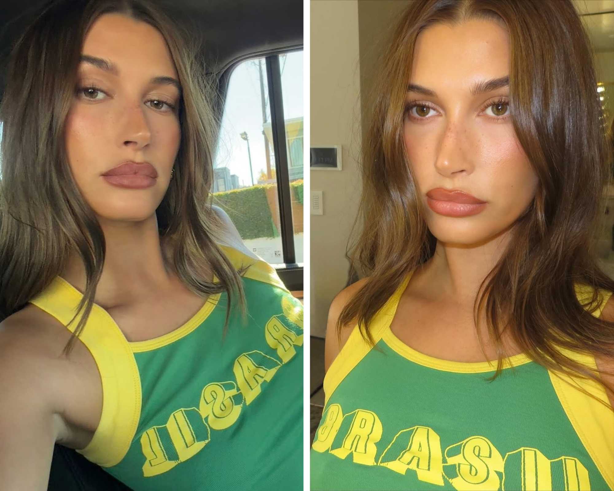 Kozmetički tretmani za lice koje radi Hailey Bieber